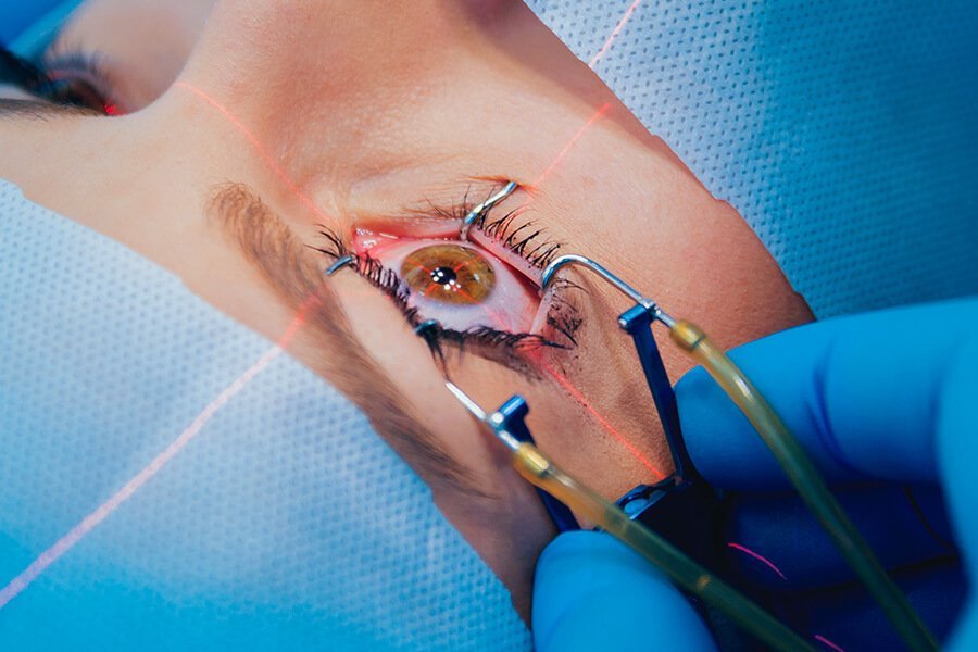 Eye Surgery and Laser Centers in Turkey